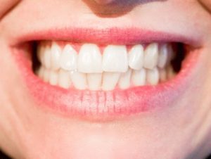 woman showing teeth 